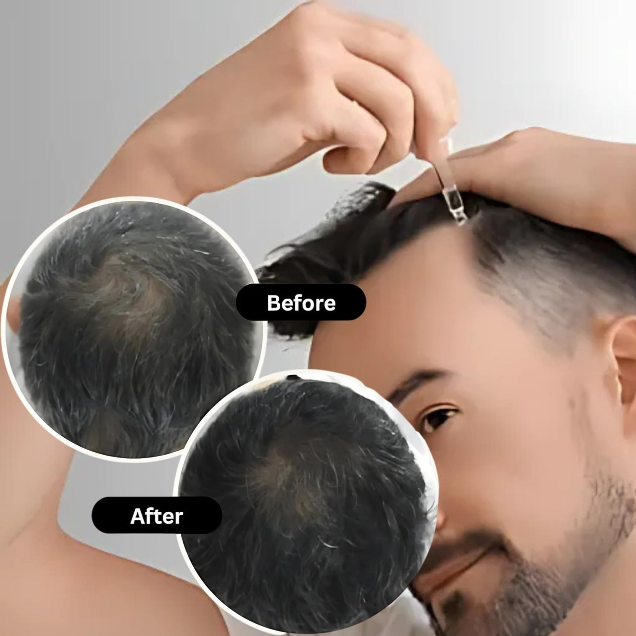 Yapidra Anti-Gray Hair & Beard Serum | Helps Reduce Graying | With Arcolys, Biotin | Lightweight, Non-Sticky & Fragrance-Free | Suitable for Men & Women | 30 ML