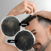 Yapidra Anti-Gray Hair & Beard Serum | Helps Reduce Graying | With Arcolys, Biotin | Lightweight, Non-Sticky & Fragrance-Free | Suitable for Men & Women | 30 ML