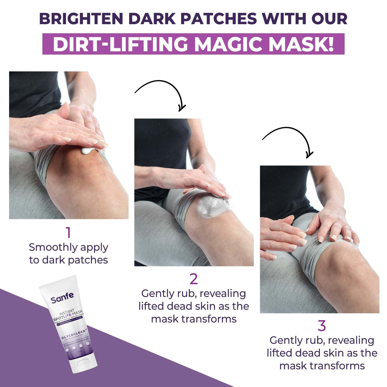 Sanfe Instant Spotlite Mask For Dark Underrams, Neck & Body| Dark Patch Removal Wipe-Off Cream in 10 Minutes | For Detanning, Anti Aging & Skin Tightening | Glycolic & Kojic acid with Charcoal 100g