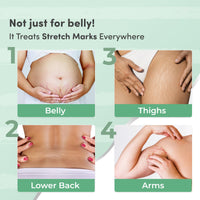 Mylo Care Stretch Marks Combo (Stretch Mark Oil - 100 ml, Stretch Marks Cream - 100 ml) |Stretch Marks removal for women |Made Safe Certified|Safe in pregnancy & effective on all body parts