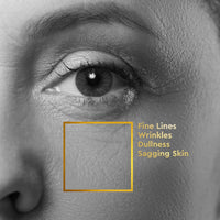 VLCC Clinic Cellulosic Peeling Face Scrub - 100g | Skin Smoothening Peeling Scrub | Weekly Exfoliation | Removes Dead Skin Cells and Excess Oil | Soft, Smooth & Clear Skin | Paraben Free