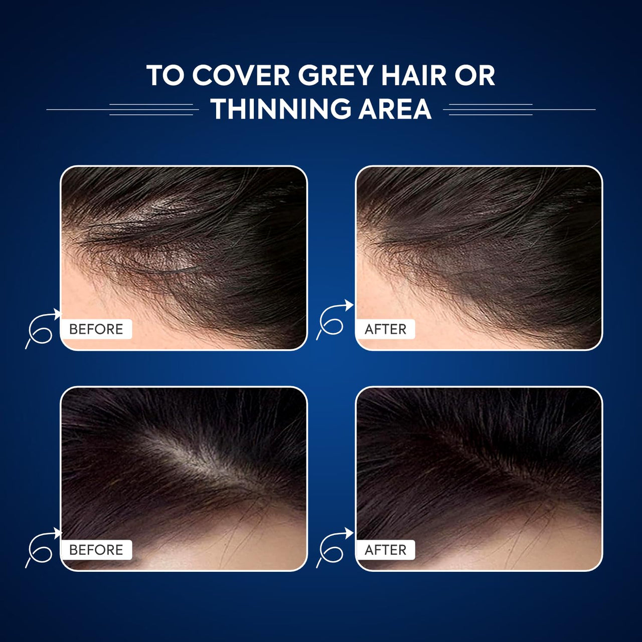 Adomour Mud Hairline Shadow Powder for Men and Women| Root touch up Powder| Sweat Resistant and Stain Proof 48 hour formula | Instantly Conceals Hair Loss, Bald Patch and Grey Hair 6g (Black)