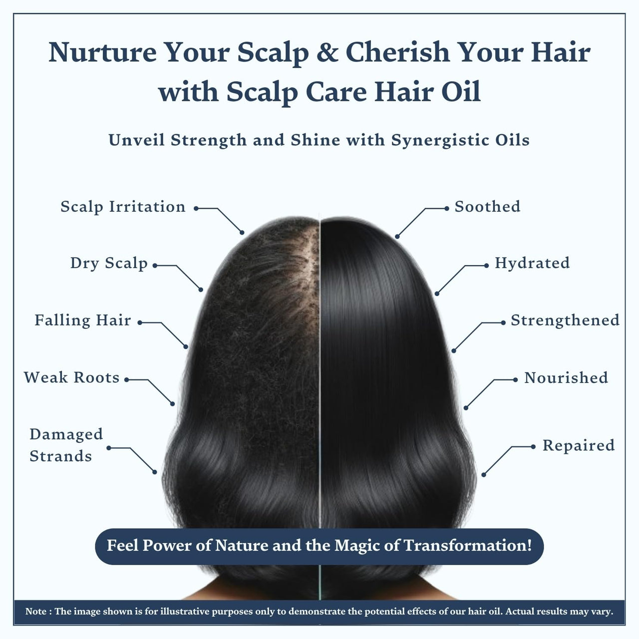 Singular Scalp Care Hair Oil for Scalp Soothing & Hair Reviving | Pure & Natural Cold Pressed Oil Infused with Nature's Best Tea Tree, Neem, Coconut, Argan, Bhringraj, Amla Oil with Vitamin E | Ideal for Nourishing Scalp & Strengthening Hair | 400 ml