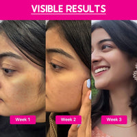 Cos-IQ 25% AHA + 2% BHA + 6% PHA Peeling Solution for Face | 10-Minute Facial | Chemical peel for face for glowing skin | Exfoliating serum| Men & Women | At-home facial | 30ml