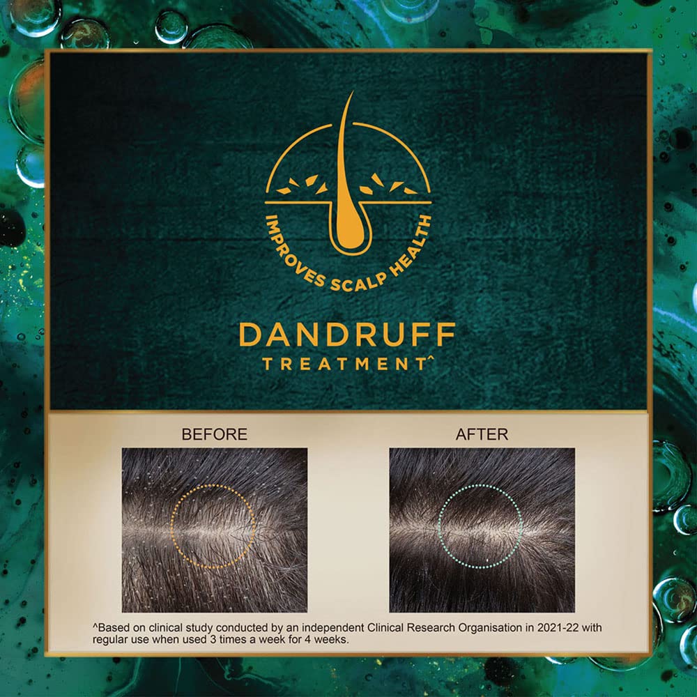 Indulekha Svetakutaja Oil|Ayurvedic Medicinal oil for dandruff treatment|100% Ayurvedic Oil|100ml