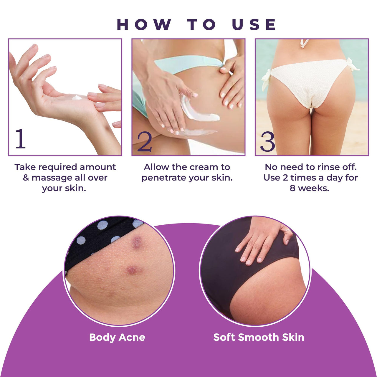 Sanfe Back & Bum Cream for Dark Spots and Body Acne | Glycolic Acid, Lactic Acid & Urea | 11% AHA & Maximum Exfoliation | Remove Dead Skin for Women | 100gm