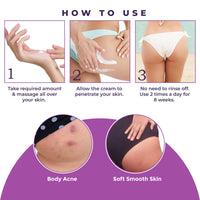 Sanfe Back & Bum Cream for Dark Spots and Body Acne | Glycolic Acid, Lactic Acid & Urea | 11% AHA & Maximum Exfoliation | Remove Dead Skin for Women | 100gm