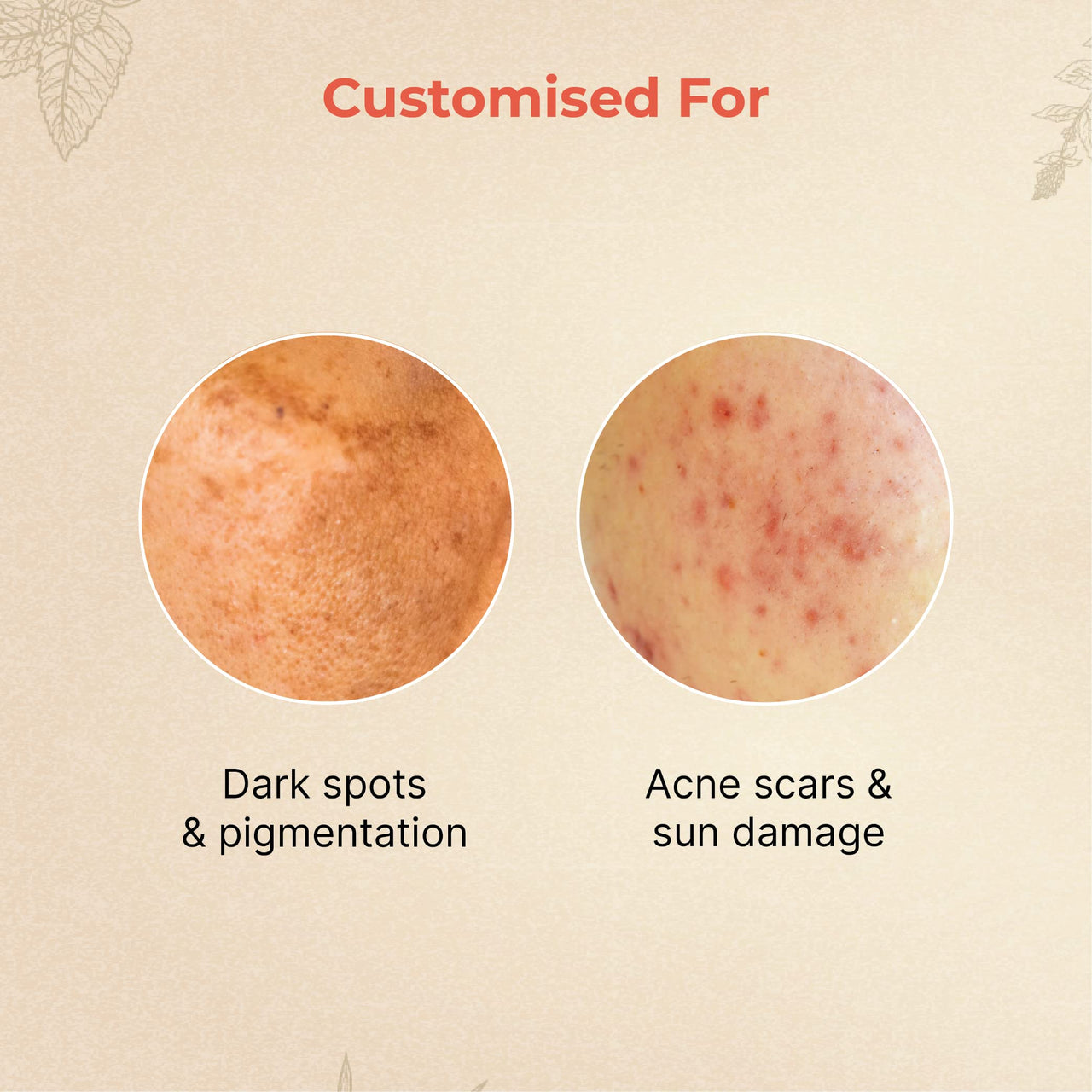 Vedix Customised Ayurvedic Face Oil | Anagh Face Oil For Pigmented Skin | With Kumkuma + Arjun + Manjishtha | For Pigmented Skin | For Dark Spots |10ml