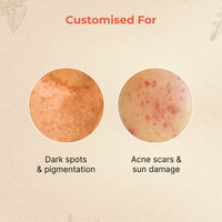 Vedix Customised Ayurvedic Face Oil | Anagh Face Oil For Pigmented Skin | With Kumkuma + Arjun + Manjishtha | For Pigmented Skin | For Dark Spots |10ml