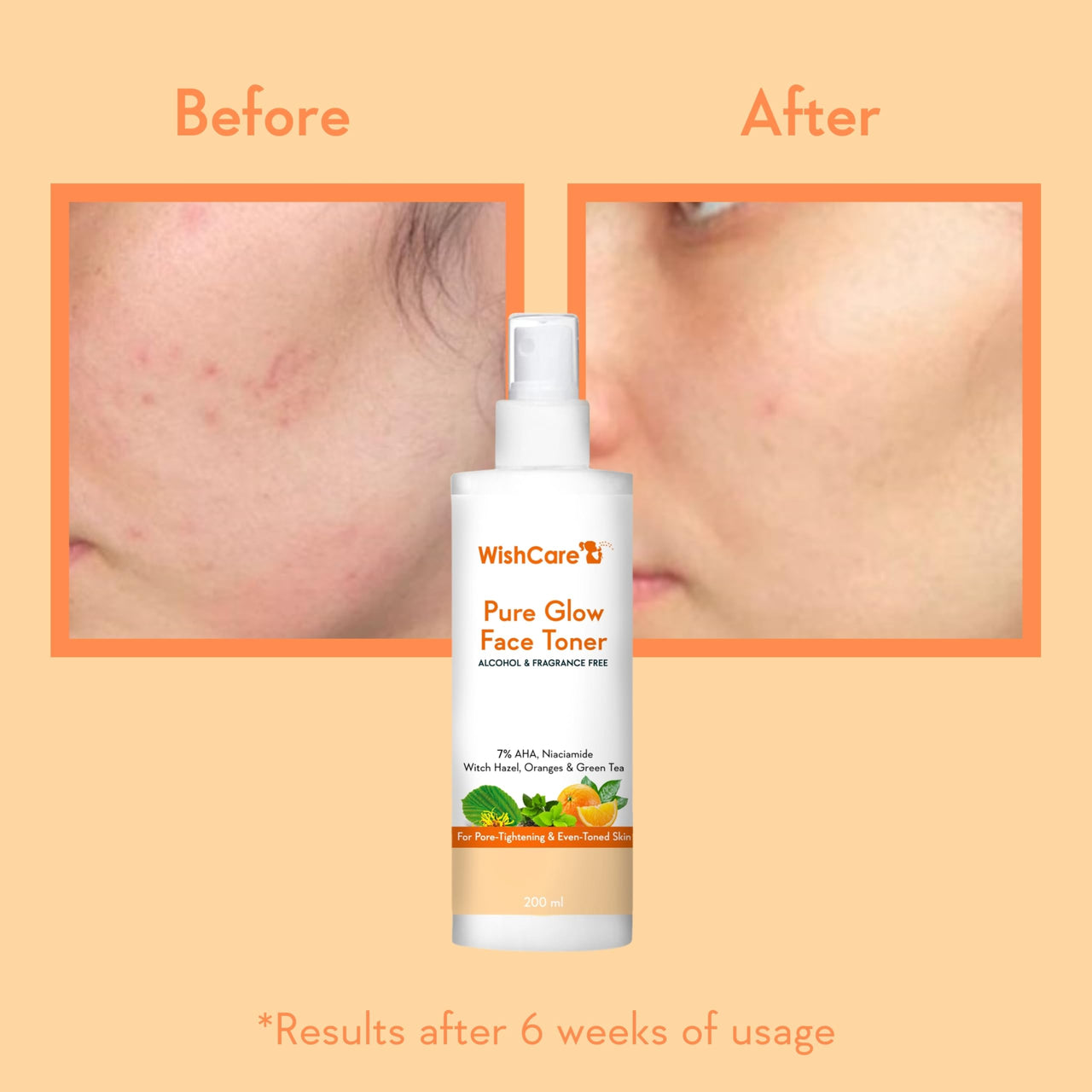 WishCare Pure Glow Face Toner - 5% Fruit AHA, Hyaluronic Acid, Niacinamide & Oranges - For Glowing, & Pore Minimizing - 200ml, (PGFT200)