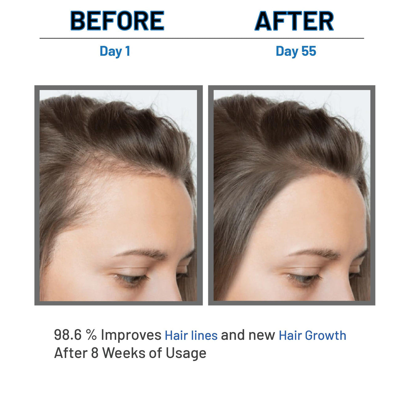 LUMOSIQUE® Hair Growth Serum helps to Hair Fall Control & Hair Growth - 30ml