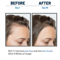 LUMOSIQUE® Hair Growth Serum helps to Hair Fall Control & Hair Growth - 30ml