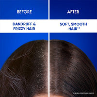 Head & Shoulders 2-in-1 Smooth and Silky Anti Dandruff Shampoo + Conditioner for Women & Men, With Almond Milk (1 L)