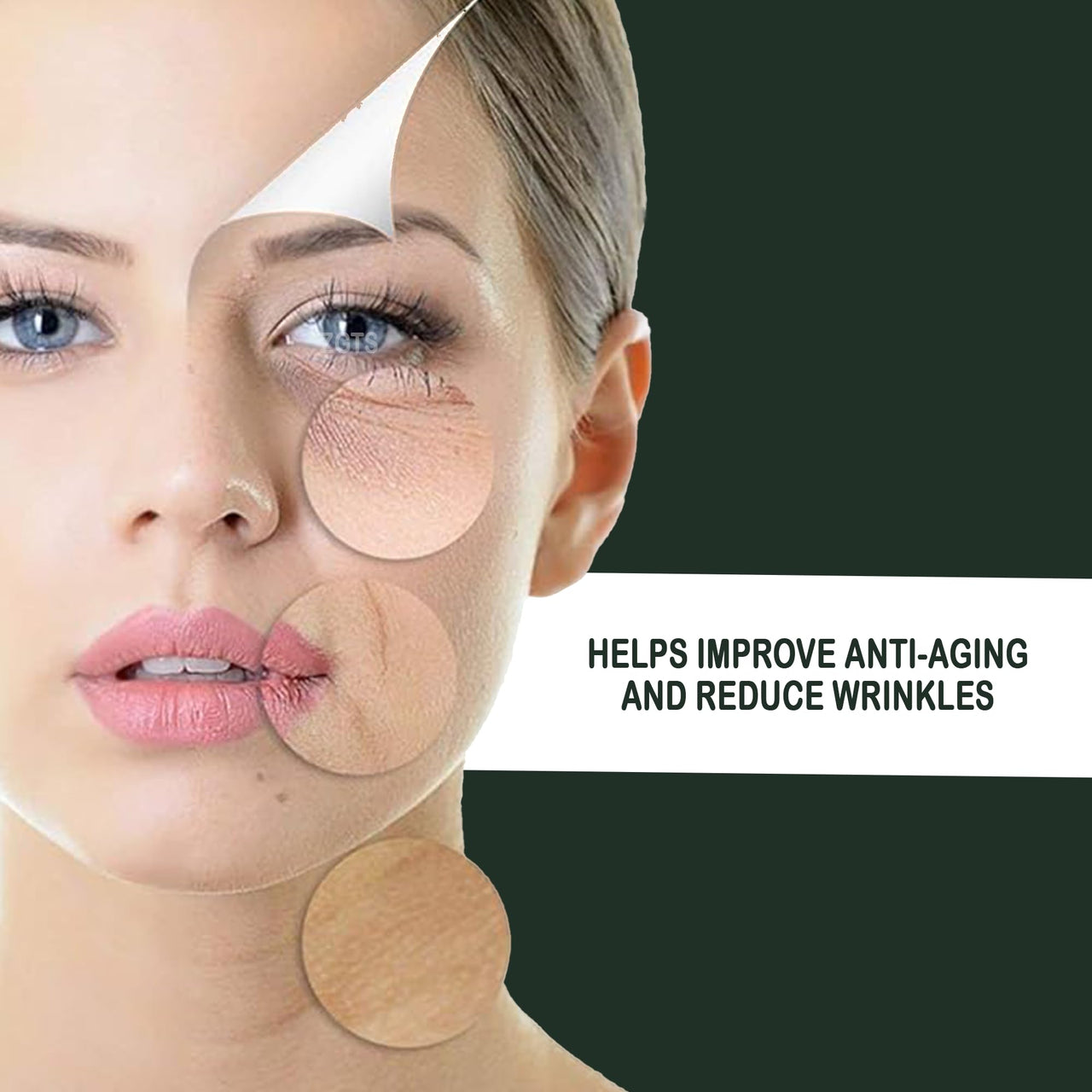 ZGTS Professional Gold Plated 192 Needles Titanium Alloy Derma Roller, Gold, 1.0 mm