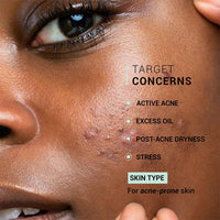 Sereko Oil Clear Face Moisturizer with NMF for Oily & Acne-Prone Skin | Controls Oil, Dehydrated Skin, Soothes Redness & Improves Texture | Lightweight, Non-Greasy Formula | Acne Cream 50ml