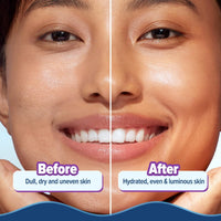 Aqualogica Illuminate + Hydra Gel Moisturizer with Wild Berries & Alpha Arbutin | 24 Hour Intense Hydration | Water-Like Gel Texture | Non-Sticky & Quick Absorbing for Luminous Skin | 200 g