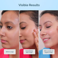 Cos-IQ AirGel NMF 15% Face Moisturizer For Oily to Normal Skin | Fast Absorbing Lightweight For Women & Men | 100ml