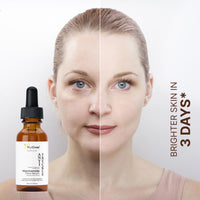 TryOnes Skin Naturals, Bright Complete 30X Vitamin C Booster Face Serum, Increases Skin's Glow Instantly and Reduces Spots Overtime for Men & Women_Anti-Fricle_30ml