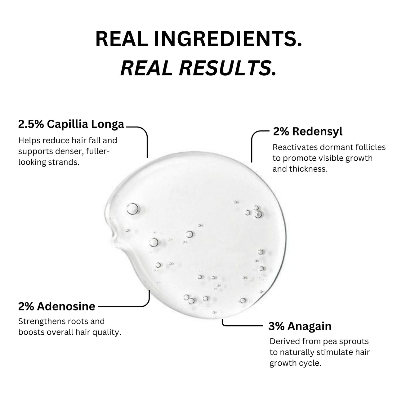 Ravel Advanced Hair Serum | 2.5% Capilia Longa + 3% Anagain + 2% Redensyl + 2% Adenosine, Rosemary & Pumpkin Seed | Promotes Hair growth | Hair Serum for Men & Women | 30ml