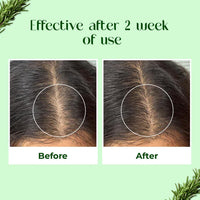 Passion Indulge Rosemary Hair oil for hair growth with Biotin | 100ml Hair Proteiniz | Reduces Hair Fall, Breakage, Promotes Hair growth naturally | Ayurvedic & Natural Hair Oil