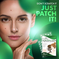 Urban Yog Acne Pimple Patch - (72 Dots) - Men and Women - (Pack of 10) (72 Dots * 10 Pack)