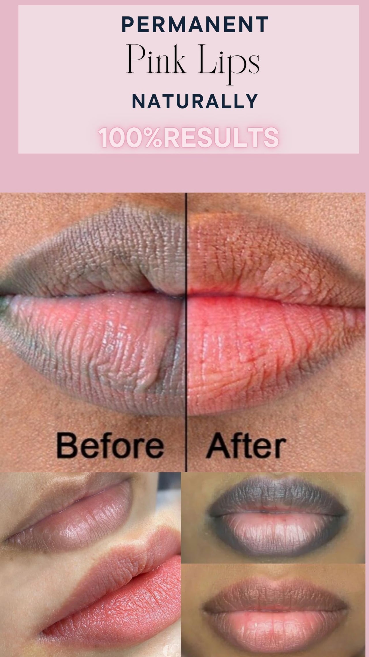 Shiv Aatman Lip Treatment Mask ( Non Chemical) for Baby Pink Lips. Reduces Pigmentation, Darkness, Roughness. Makes Lip Naturally Pink, Soft, Plump. 2 Products Free - Beetroot & Ghee Lip Butter & Face Brightening Face Wash. (12 gram)