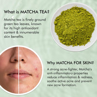 mCaffeine 1% Salicylic Acid Acne Arrest Spot Corrector with 1% Succinic Acid & Matcha Tea | Anti Acne Gel for Active Acne & Acne Scars | Reduces Acne Size & Redness | Soothing & Non-Drying for both Women and Men - 15 ml