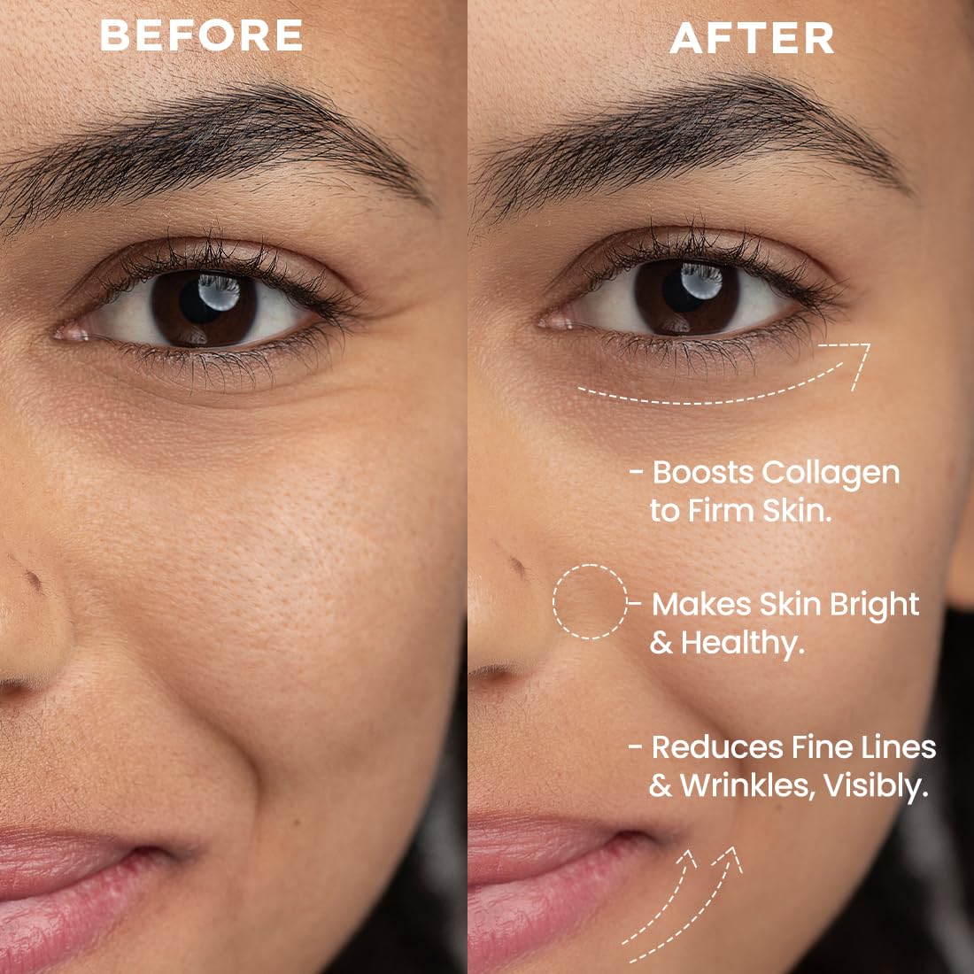 Hyphen 0.05% Retinal Reset Serum | 30% More Effective than Retinol Serum | Anti Ageing Reduces Fine Lines & Wrinkles Night Face Serum For Beginners | Serum for Women | Boosts Collagen & Brightens Skin- 30 ml