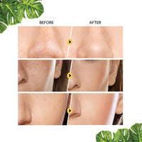 Orgatre Ubtan Face Mask Stick For Men & Women For Sun Tan, Natural Glow With Natural Haldi | 40 Grams