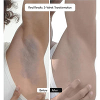 Cos-IQ Brightening Underarm Roll On Serum for Men | With Bioecolea, Mandelic Acid and Bio White | Fresh & fragranced | Suitable for Sensitive Skin | 40ml