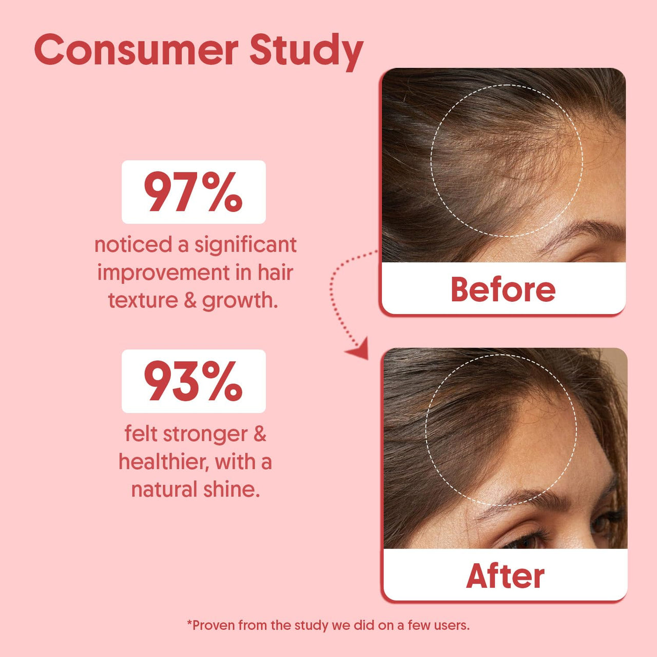 Aravi Organic Batana Hair Oil For Hair Growth With Pumpkin Oil - Derived From American Oil Palm Nut - 200 ml