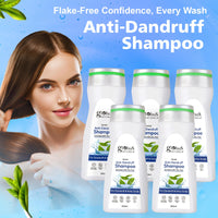 Globus Naturals Anti Dandruff Shampoo, For Dandruff and Itchy Scalp, Suitable For All Hair Types, 200 ml (Pack of 5)