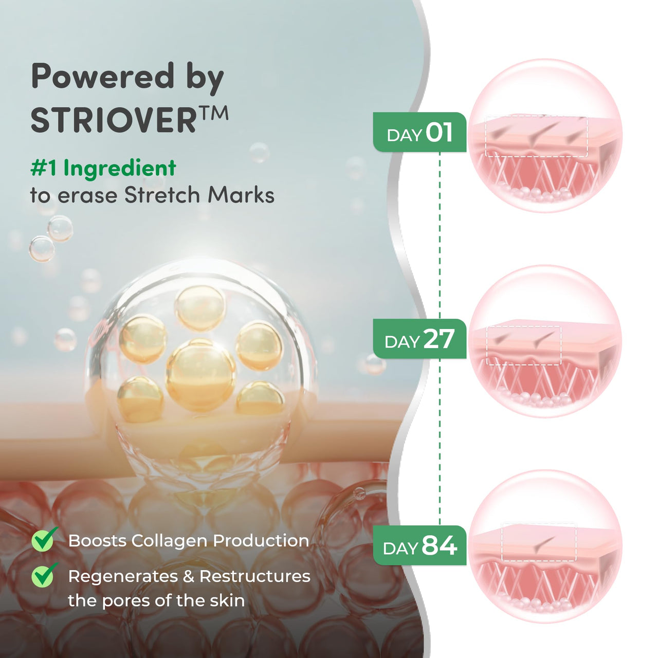 Mylo Care Stretch Marks Combo (Stretch Mark Oil - 100 ml, Stretch Marks Cream - 100 ml) |Stretch Marks removal for women |Made Safe Certified|Safe in pregnancy & effective on all body parts