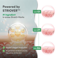 Mylo Care Stretch Marks Combo (Stretch Mark Oil - 100 ml, Stretch Marks Cream - 100 ml) |Stretch Marks removal for women |Made Safe Certified|Safe in pregnancy & effective on all body parts