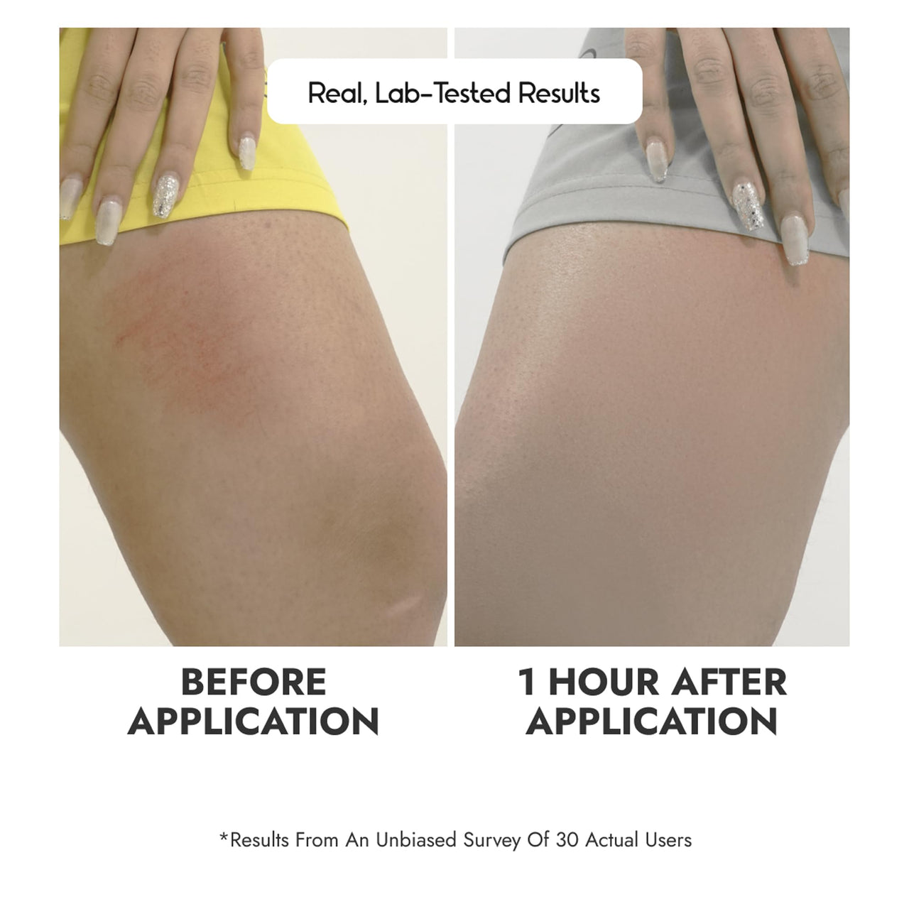 Cos-IQ Anti Chafing Roll-On Serum for Men & Women | With Bioecolea & Inulin | Prevents Arm, Chest, Butt, Thigh, Ball Chafing, Sweat, Odor, Irritation & Rashes | 40ml