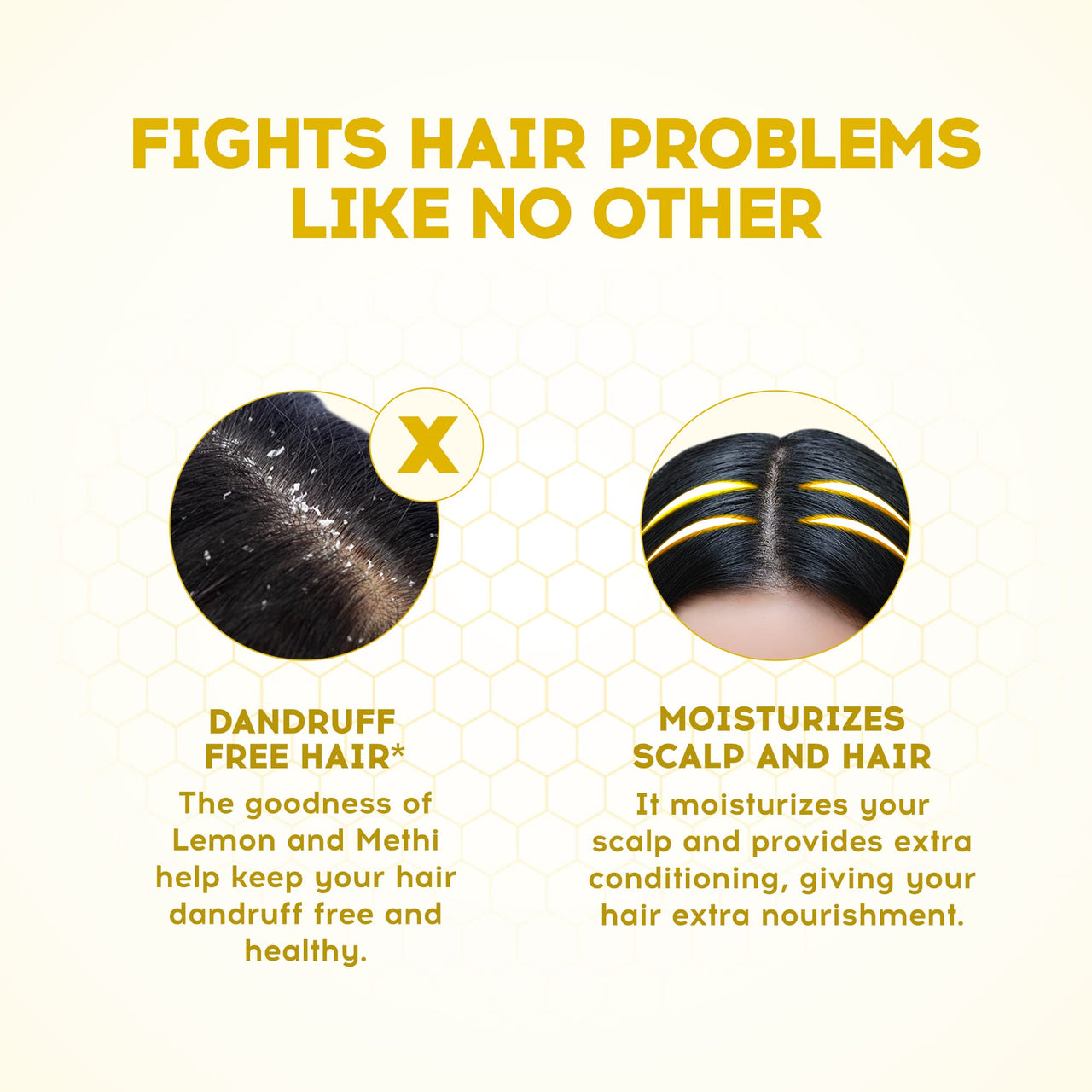 Dabur Vatika Lemon Anti-Dandruff Shampoo - 640ml | Reduces Dandruff from 1st wash | Moisturises Scalp | Provides Gentle Cleansing, Conditioning & Nourishment to Hair