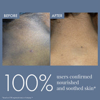 ThriveCo Dark Patches Corrector Cream| Dark Patches Removal | With Retinal &Niacinamide for Dark Neck, Underarms, Inner Thighs, Knuckles, Elbows & Knees. Men & Women | 100ml