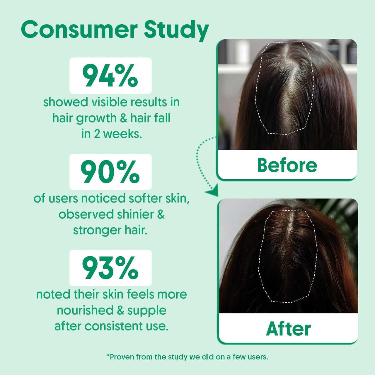 Aravi Organic Rosemary Lavender Hair Oil For Healthy Scalp, Hair Roots - 100% Pure & Natural - For Hair Growth & Hair Fall Control - 200 ml