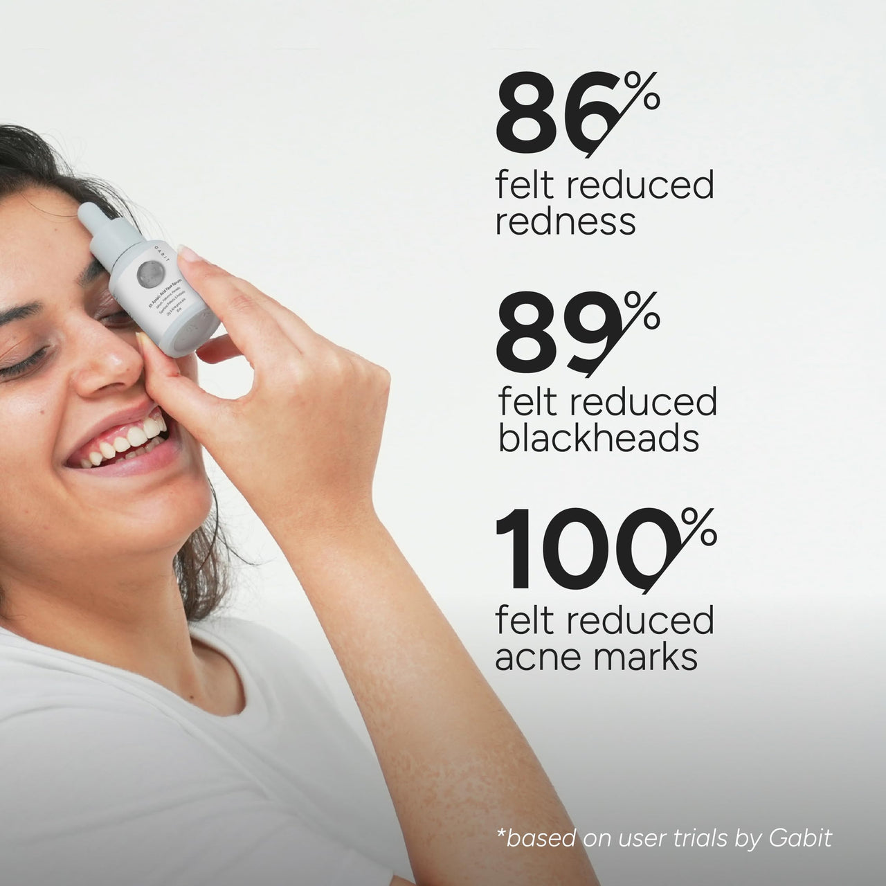 Gabit 5% Azelaic Acid Face Serum For Acne,Blackheads,Open Pores & Spots|Salicylic (1%),Hyaluronic,Green Tea,Prebiotic,Probiotic|For Oily,Acne Prone Skin|Oil & Fragrance free|For Women & Men,30 ml