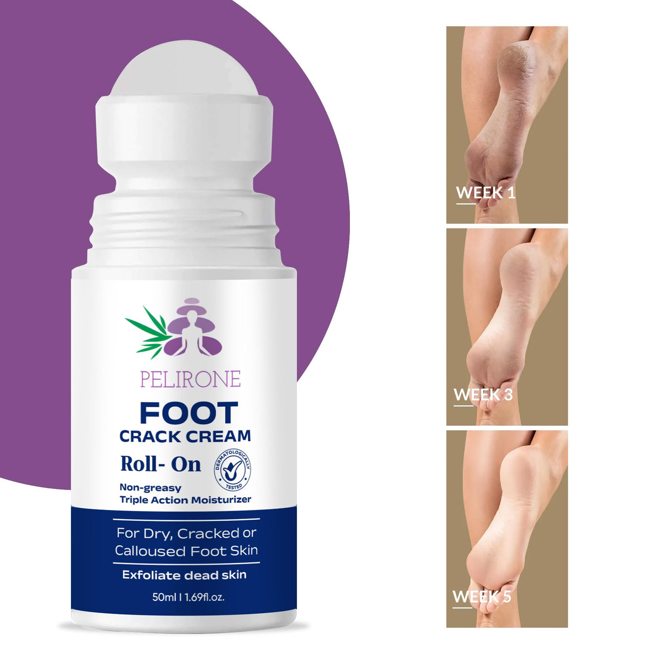 PELIRONE Urea Foot Cream Roll-On 50ml – 20% Urea with 2% Lactic Acid, Olive Oil & Vitamin E for Deep Moisturizing and Repair of Dry, Cracked Heels and Feet