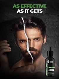 Beardo 2-in-1 Anti Acne Serum + Toner For Men, 30ml | Face Serum For Men | Acne Serum with AHA & Niacinamide | Reduces Pores & Acne Scars for Smooth Skin