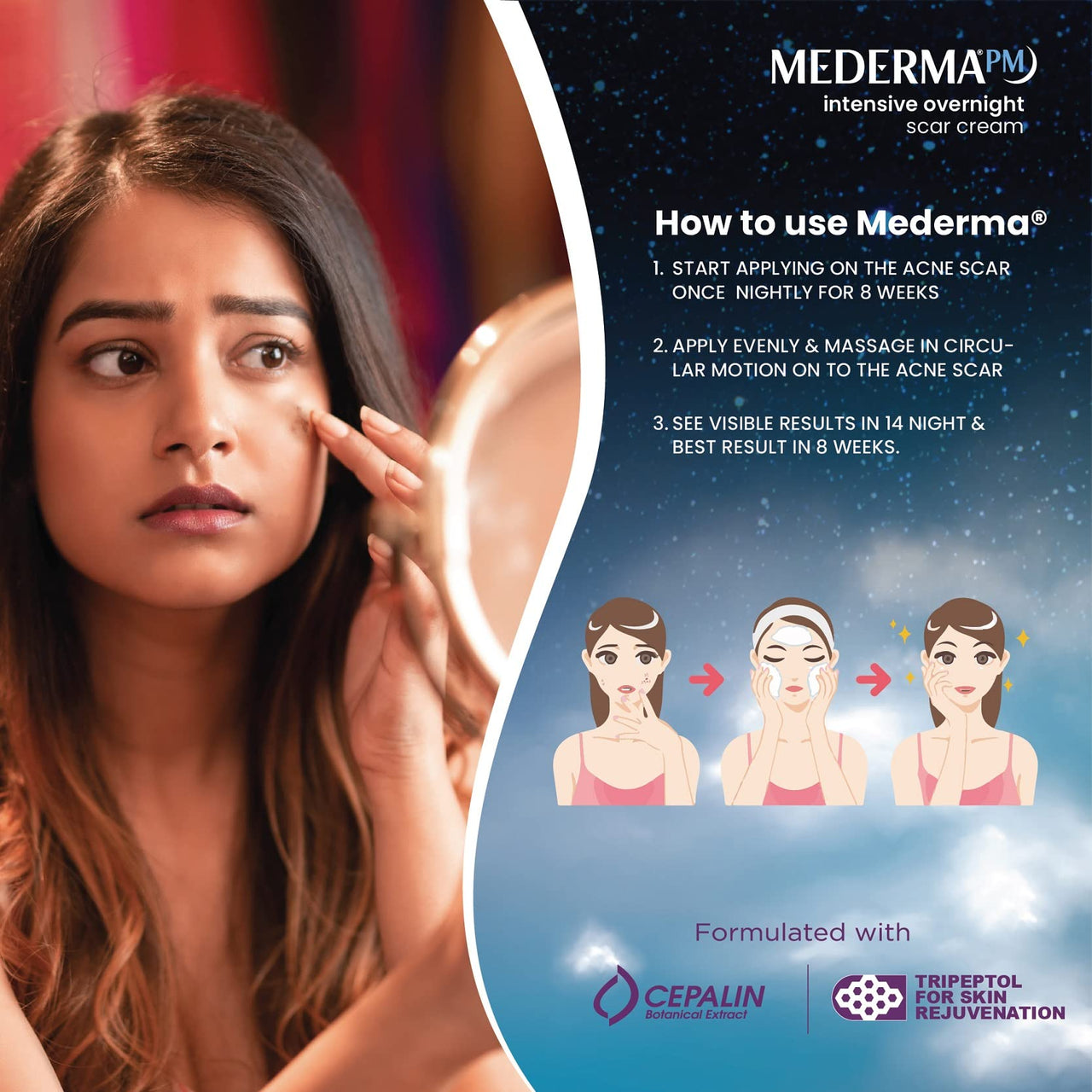 Mederma Intensive Overnight Cream 30g-Works with Skin's Nighttime Regenerative Activity - Once-Nightly Application Is Clinically Shown to Make Scars Smaller & Less Visible