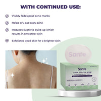 Sanfe Dark Spots & Acne Clearing Body Soap | Prevents Body Acne, Bumpy Skin & Fades Dark Spots | Salicylic Acid 2% W/W, Benzoyl Peroxide | Non Drying Formula (Pack of 1)