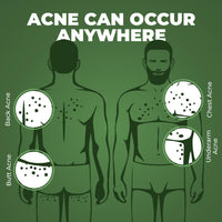 BEARDO B-acne Clear Body Wash & Ball Sack Intimate Wash For Men | Body Acne Clear 2 Items in the set