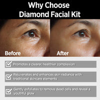 Multani Naturals Diamond Facial Kit For Instant Glow & Removes Dead Skin Cells | 6 Products in one Box | Cleansing Cream , Massage Cream , Scrub, Face Pack , massage Gel and Free Face Wash (65ML) | 100 ml