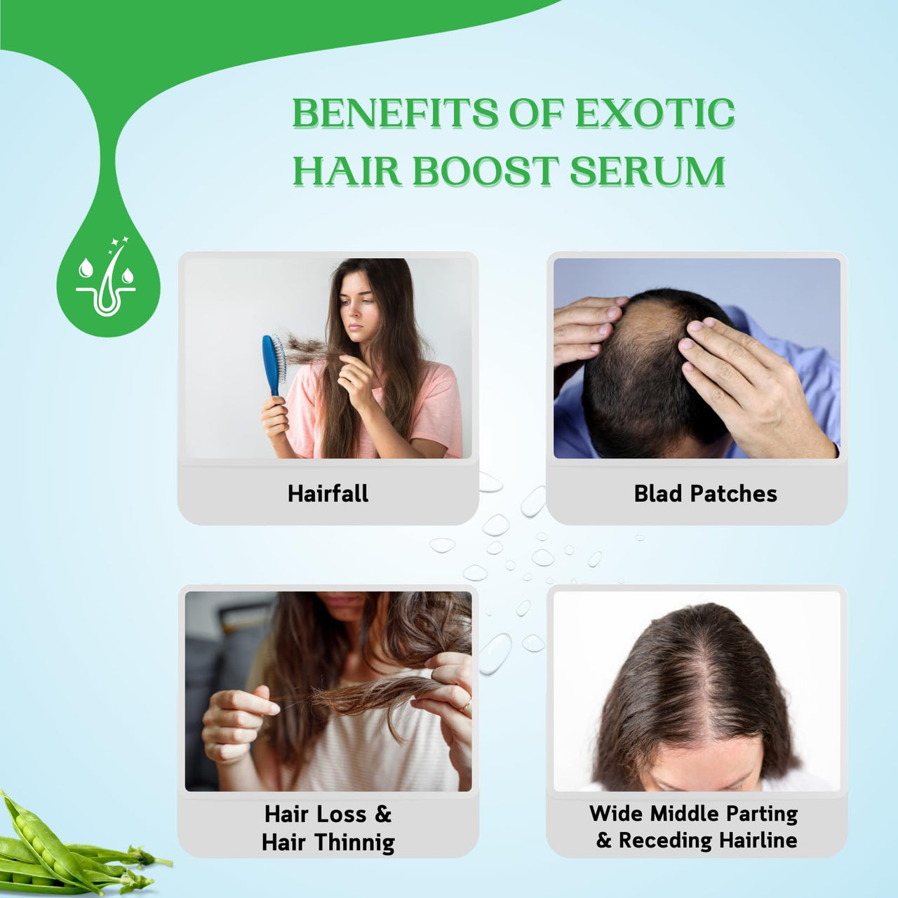 Exotic Aromas-Exotic Hair Boost Serum with 3% Redensyl, 3% Rosemary, 4% Anagain & 4% Biacapil, 30 ML, for hair loss, hair growth, thinning, baldness, for thicker & denser Hair. For Men & Women