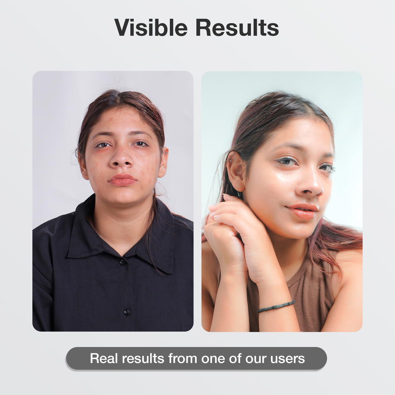 Cos-IQ FC-1 Face Wash for Oily Skin | Matte Finish, Non-Drying Daily Gentle Cleanser | Fight Acne & Pimples, Brightens Skin, Clears Dirt, Refreshing Feel | Non-Comedogenic for Men & Women | 100ml