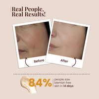 La Pink Ubtan Face Wash | Gently Exfoliates & Brightens Skin | Removes Tan, Dirt & Impurities | With Walnut Beads, Kesar, Sandalwood & White Haldi | Soap-Free & 100% Microplastic-Free | All Skin Types | 100ml