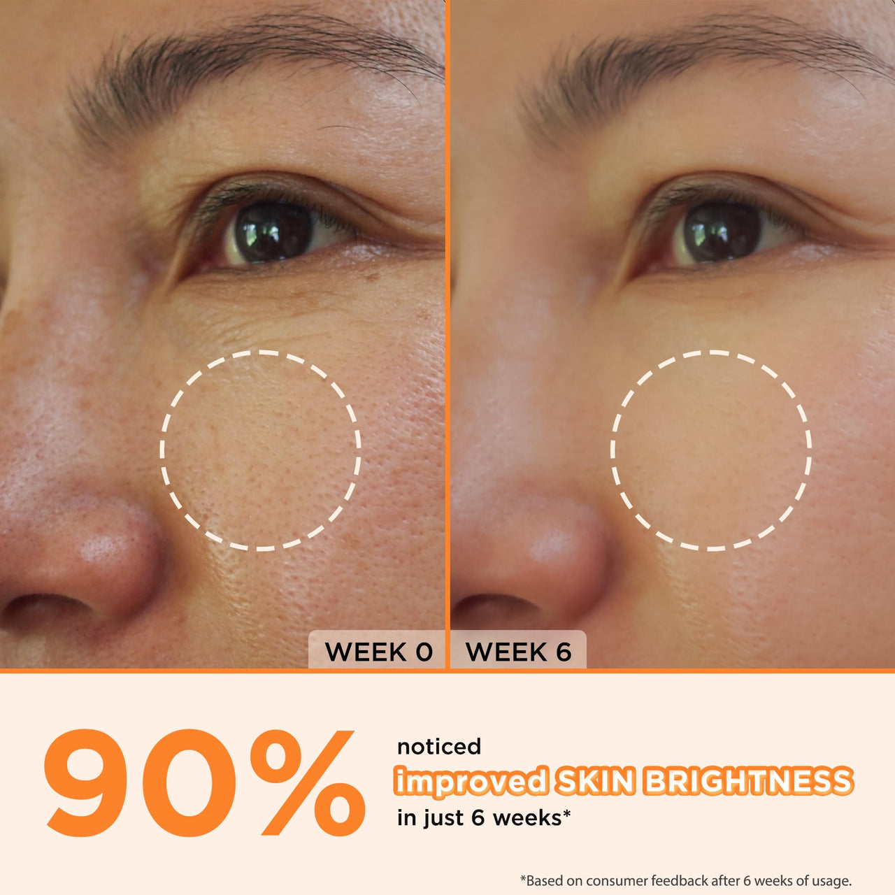 ORGATRE 30% Vitamin C Face Serum 30ml | Reduces Fine Lines & Wrinkles | Prevents Sunburn | Reduces Smoothes Uneven Skin | For Men & Women