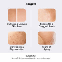 Cureskin Vitamin Boost D Tan Face Mask for Glowing Skin | D Tan Pack for Tan Removal | Fruit Based AHA Tan Removal De Tan Face Pack Mask for Women & Men | Detan Pack for Tan Removal | Tan Removal Cream